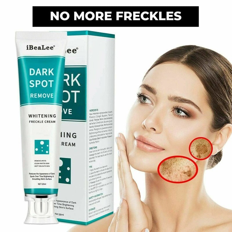 iBeaLee Whitening Freckle Cream Remove Melasma Acne Spot Pigment Melanin Dark Spots Whitening Moisturizing Cream Skin Care - Lozenza